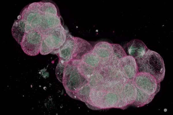 Precision Complement Testing: A Cornerstone of Modern Immunological Research