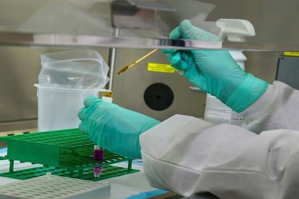 Glycan Profiling: The Comprehensive Guide to Analysis and Applications