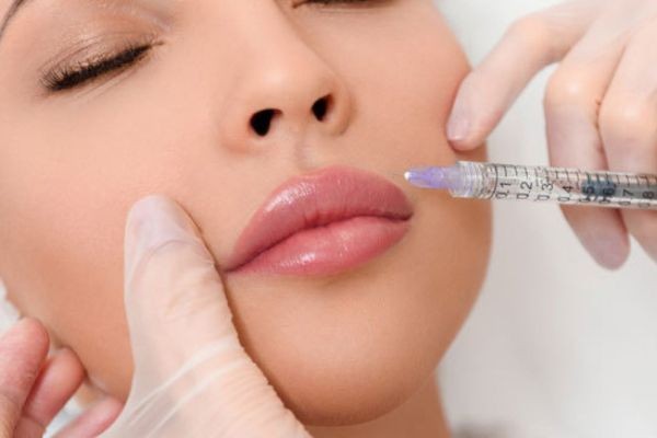 Lip Fillers in Plano, Texas: Everything You Need to Know
