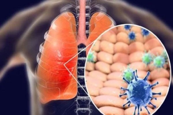 How IgA, IgE, and IgY Are Transforming Antibody-Based Cancer Research