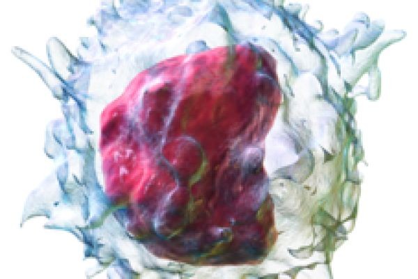 From Inflammation to Immune Evasion: The Central Role of IL-6 and BCL2