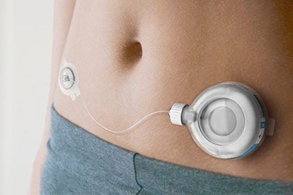 Wearable Pregnancy Devices Market Forecast: Emerging Technologies Enhancing Maternal and Fetal Health Monitoring