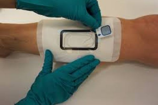 Advanced Wound Care Market Expanding Rapidly Through Innovation and Global Healthcare Integration