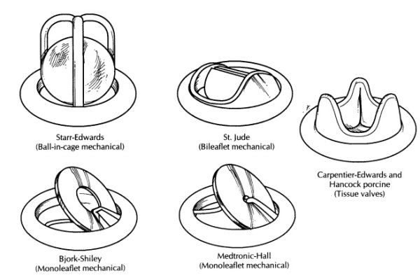 Prosthetic Heart Valves Market Global Expansion, Market Forecast, and Emerging Innovations in Cardiac Devices