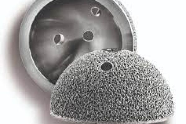 3D-Printed Hip And Knee Implant Market Advancing With Artificial Intelligence And Machine Learning Technologies