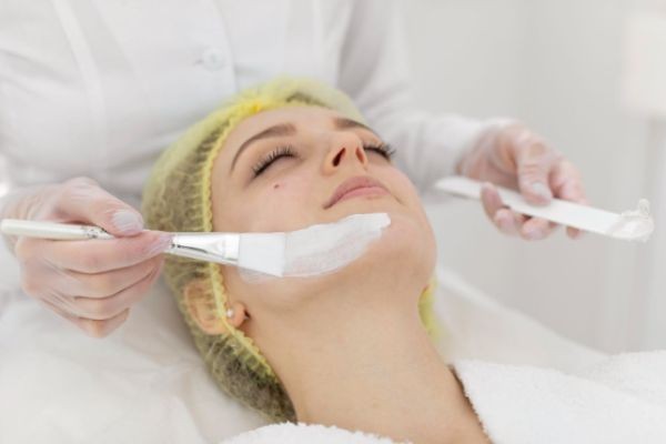 How to Choose a Chemical Peel in Houston: Expert Tips