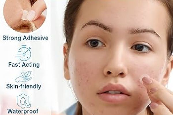 Anti Acne Dermal Patch Market Expanding Rapidly With Innovative Skincare Solutions