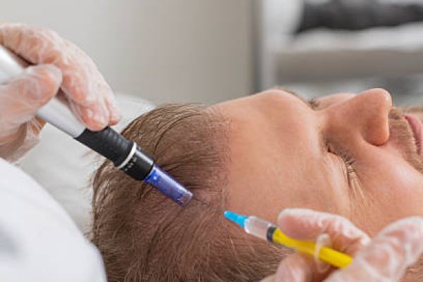 Future of Exosomes Hair Treatment: 2026 Riyadh Trends