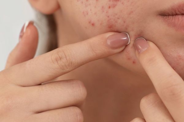 How Technology is Revolutionizing Pigmentation Treatment