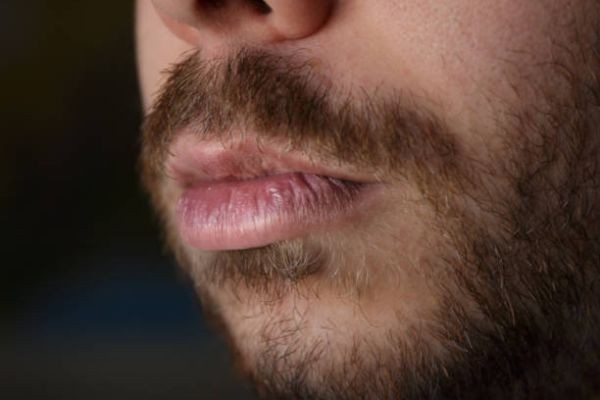 Erase Smoking Marks: Lip Restoration Treatments