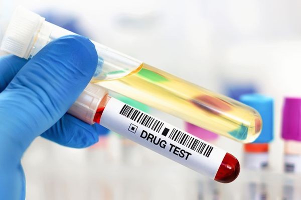 Best Drug Screening Services Quick Reliable in Canada