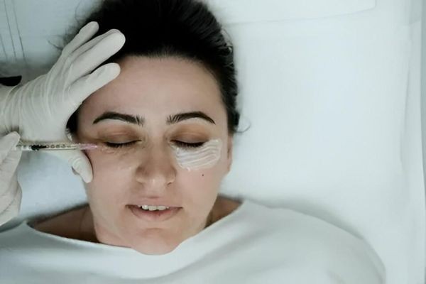 Under Eye Filler Islamabad for Tired Eyes