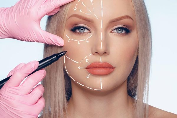 Why Thread Lift Is the Smarter Facelift Alternative People Are Choosing in 2026