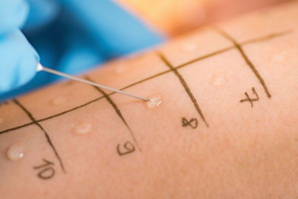 Best Allergy Clinic in Dubai Providing Safe and Reliable Treatments