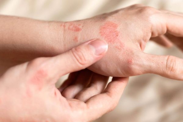 Treating Bacterial Infections: The Role of Generic Ciprofloxacin