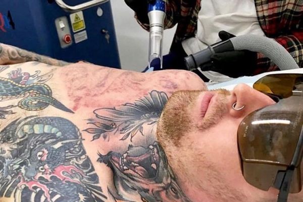 Clear Skin Transformation Through Laser Care