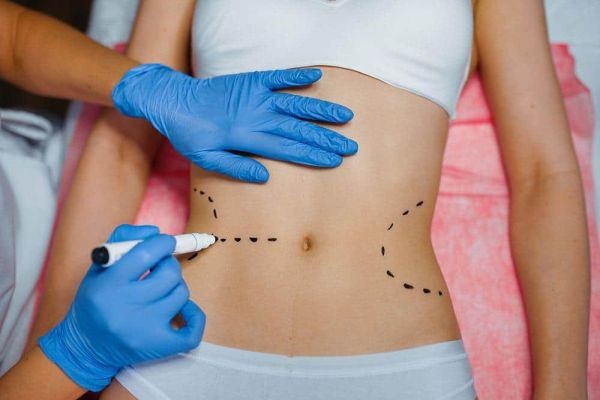 Eligibility Criteria for Bariatric Surgery in Islamabad