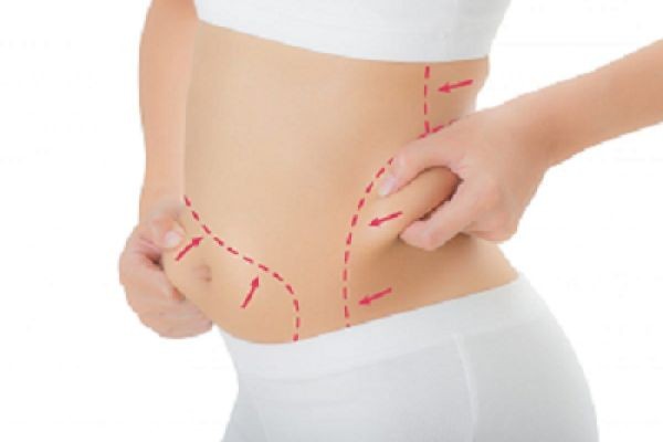 Fat Melting Injection in Dubai: Modern Body Sculpting Tech