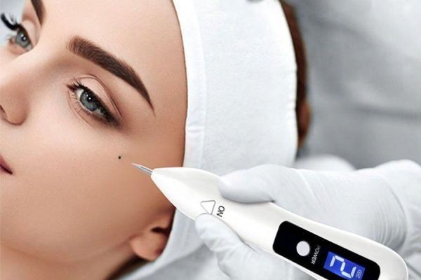 Mole Removal in Dubai: Expert Techniques for Clearer Skin