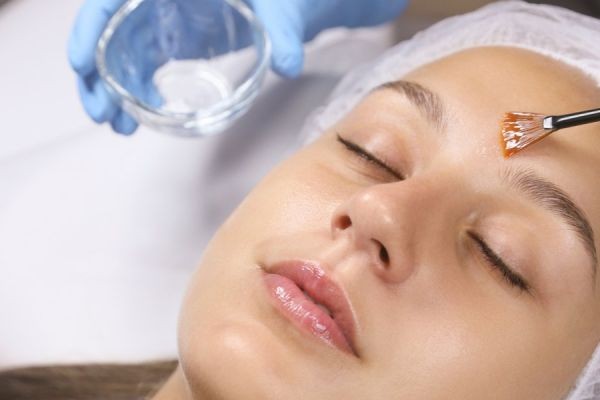 Achieving a Radiant Glow: Understanding Chemical Peels for Uneven Skin Tone