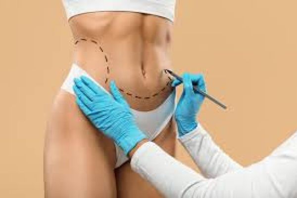 Top-Rated Liposuction Surgeons in Dubai for Fat Reduction