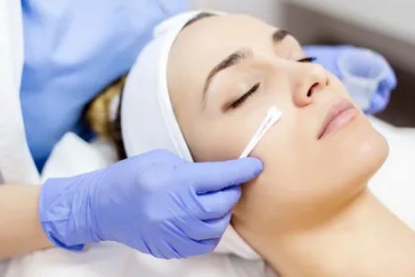 Chemical peels in Dubai: Advanced Solutions for Melasma