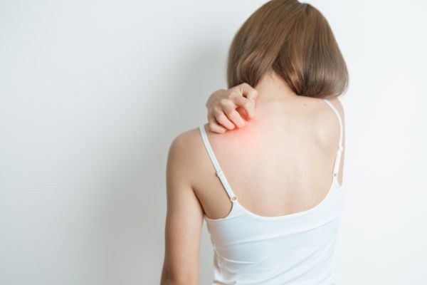 Stop Confusing Lupus Rash with Rosacea: Here’s How to Tell