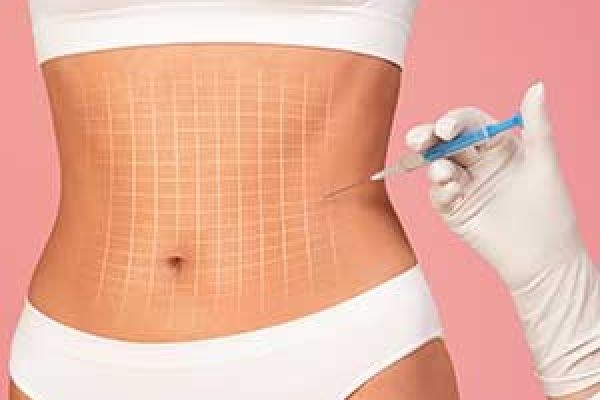 Fat Melting Injections for Body Slimming: How They Work