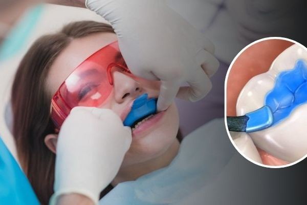 Dental Sealants Market Growth Influenced By Rising Pediatric Preventive Care Demand