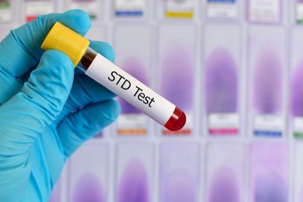 Trusted STD Testing Labs in Dubai