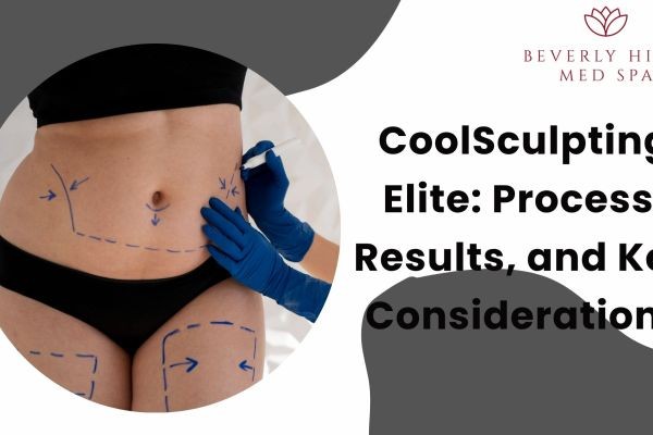 CoolSculpting Elite: Process, Results, and Key Considerations