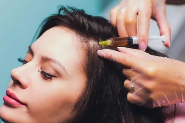 PRP Hair Treatment in Dubai vs Hair Transplant: Making the Right Choice