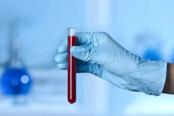 Visa Blood Test: A Complete Beginner-Friendly Guide