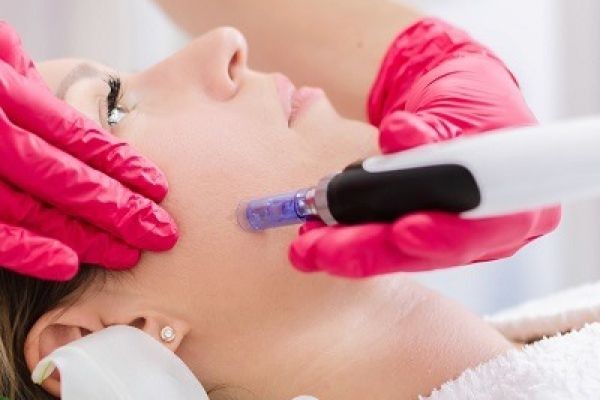 Skin Health Enhancement with PRP Microneedling Dubai | Natural Skin Rejuvenation Guide