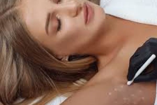 Hyperhidrosis Treatment Techniques Available in Dubai | Effective Excessive Sweating Solutions