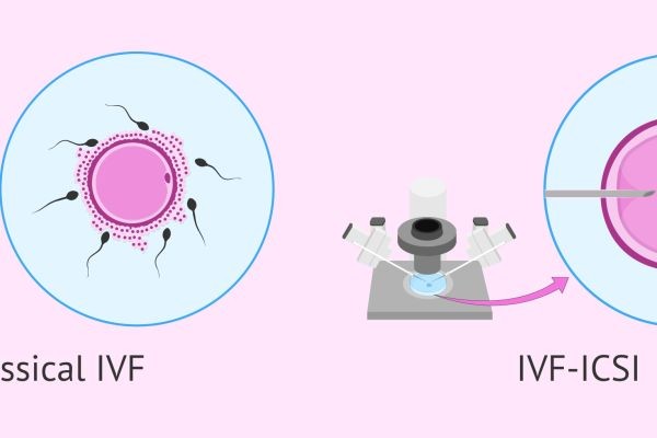 IVF and Gut Health: The Surprising Connection Between Your Microbiome and Fertility Treatment
