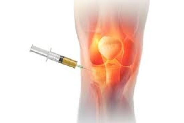 PRP Therapy for Ligament Injuries in Dubai: A Natural Approach to Recovery and Healing