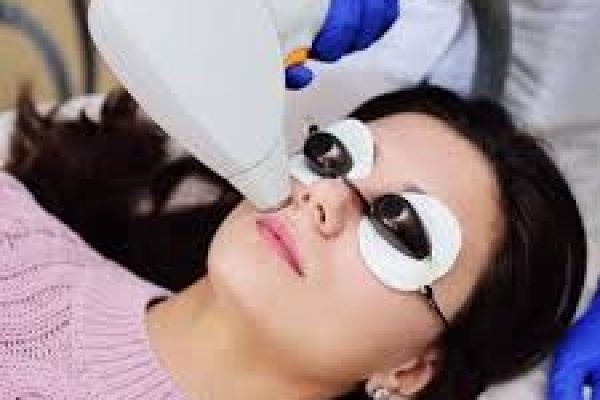 Laser Hair Bleaching for Dark Pigmentation in Dubai: A Modern Approach to Smoother, Brighter Skin