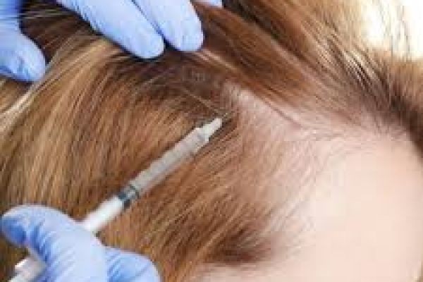 PRP Hair Therapy with Certified Dermatologists in Abu Dhabi for Natural Hair Restoration