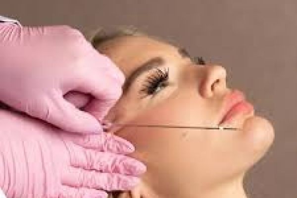 Thread Lift in Dubai – Advanced Non-Surgical Solution for Natural Facial Rejuvenation