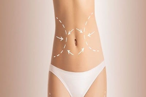 Safe Liposculpture Procedures in Dubai for Natural Body Contouring and Lasting Confidence