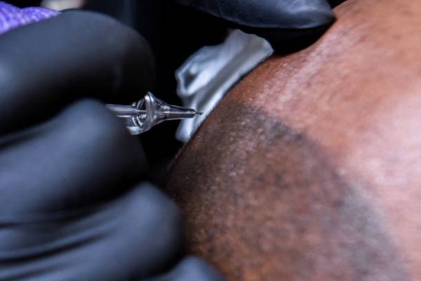 Get a Fuller Hair Look Instantly with Scalp Micropigmentation Treatment in Islamabad