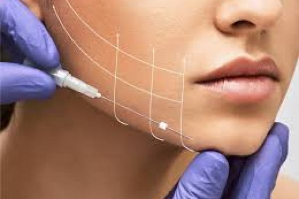 Facial Skin Tightening with Threads in Dubai: A Complete Guide