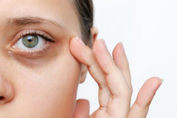 Fix Under-Eye Darkness in Islamabad – Proven Treatments