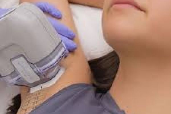 Hyperhidrosis Treatment Procedures in Dubai: Effective Solutions for Excessive Sweating