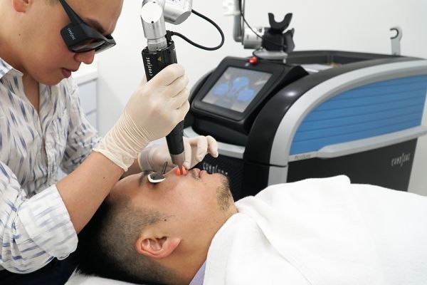 PicoSure Laser Treatment for Sun Damage: A Complete Overview