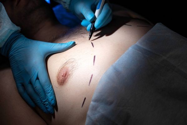 How Safe Is a Modern Breast Surgery Clinic?