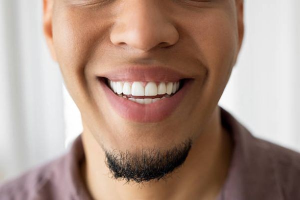 Achieve a Stunning Smile Transformation with Dental Veneers