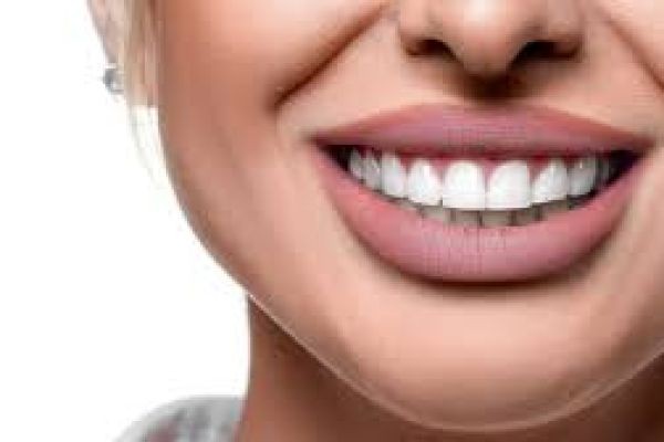 Hollywood Smile in Islamabad: Enhance Your Smile with Advanced Cosmetic Dentistry