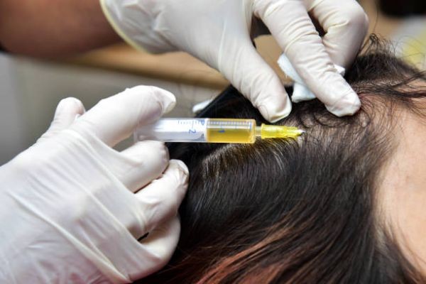 Exosome Hair Therapy in Islamabad – Advanced Cellular Regeneration for Hair Loss